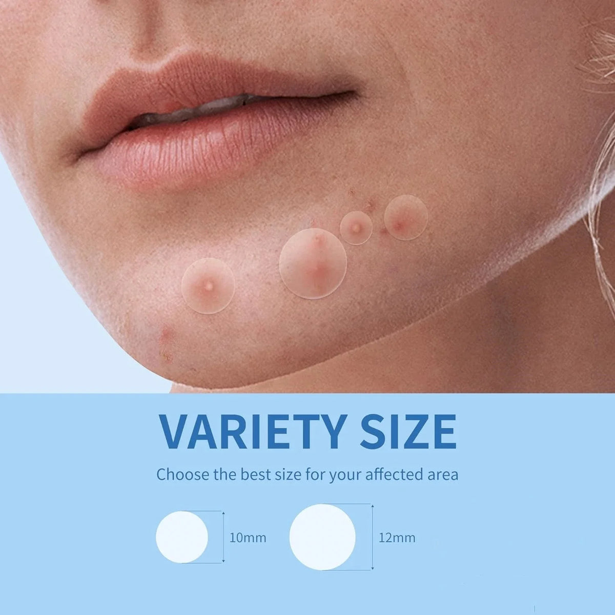 Doodad Co. Acne Patch Stickers — Invisible, Multi-Pack